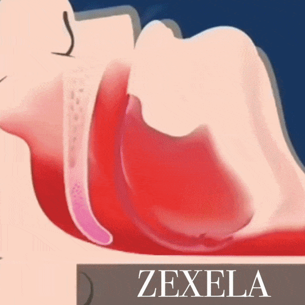 Zexela SilentSleep Anti-Snoring Mouthpiece